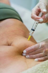 Docto performing an injection in the patient's belly for the reduction of fat and cellulite.